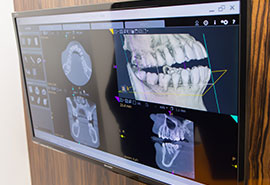 より安心な治療を希望される方へ3DCT撮影